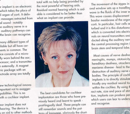 1994